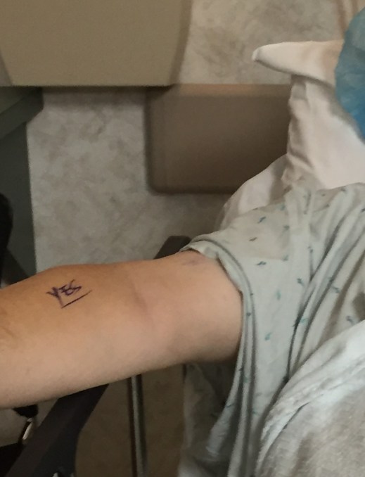 chucks-arm-before-surgery